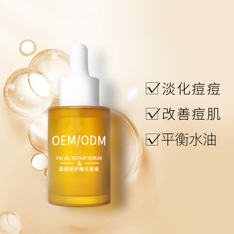优悠_祛痘精华原液OEM